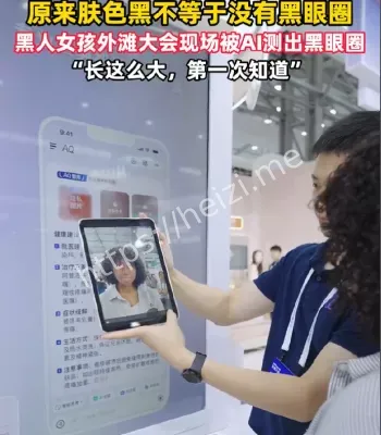 非洲女孩AI黑眼圈诊断